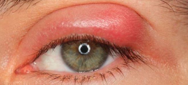 фото3 инструкция тобрекс