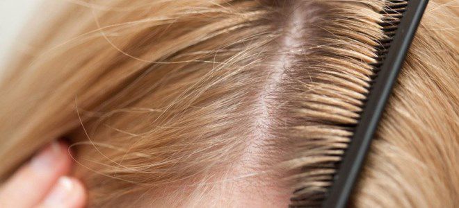 шампунь для жирных волос у корней шампунь для жирных волос у корней