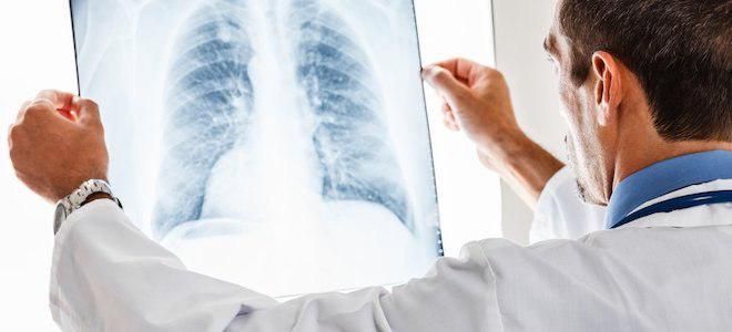 виды бронхита виды бронхита