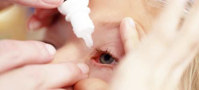 воспаление слизистой глаза воспаление слизистой глаза