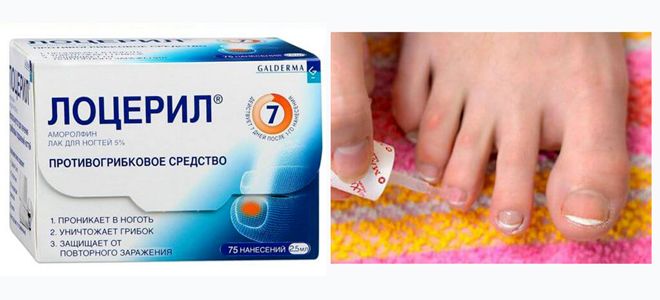 антимикотические препараты антимикотические препараты