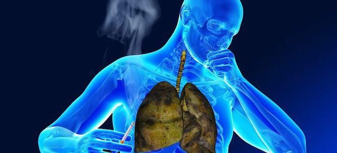 как распознать бронхит как распознать бронхит