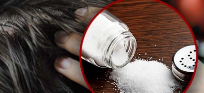 натуральные средства от выпадения волос натуральные средства от выпадения волос