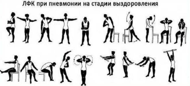 полисегментарная пневмония последствия полисегментарная пневмония последствия