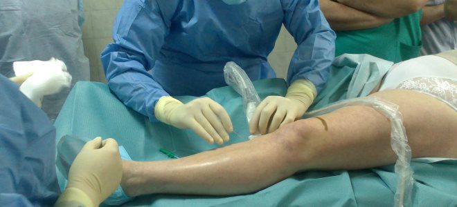 трофическая язва операция трофическая язва операция