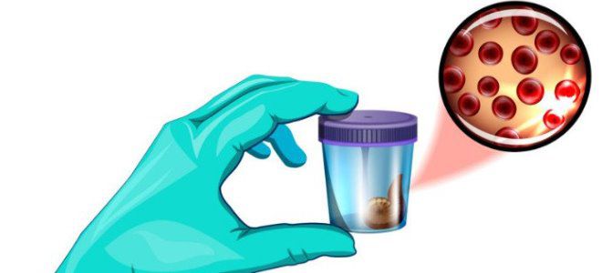 анализ на скрытую кровь в кале анализ на скрытую кровь в кале