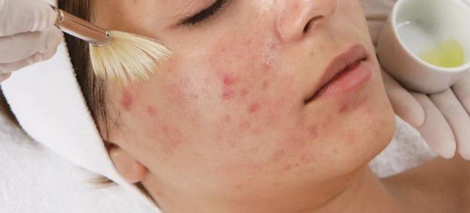 глубокий массаж лица глубокий массаж лица