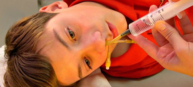 как промывать нос шприцом как промывать нос шприцом