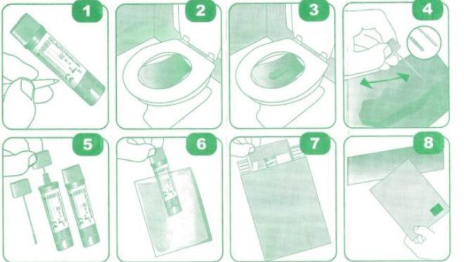 как собрать кал на анализ как собрать кал на анализ
