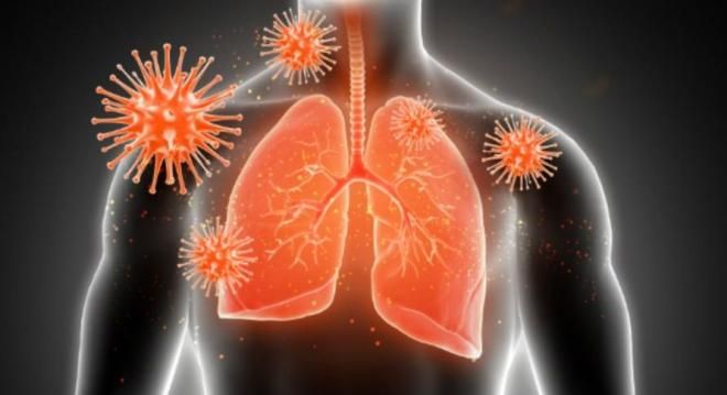 осложнения коронавирусной инфекции осложнения коронавирусной инфекции