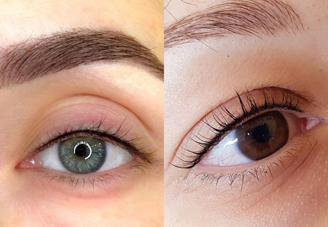 неудачная межресничка неудачная межресничка