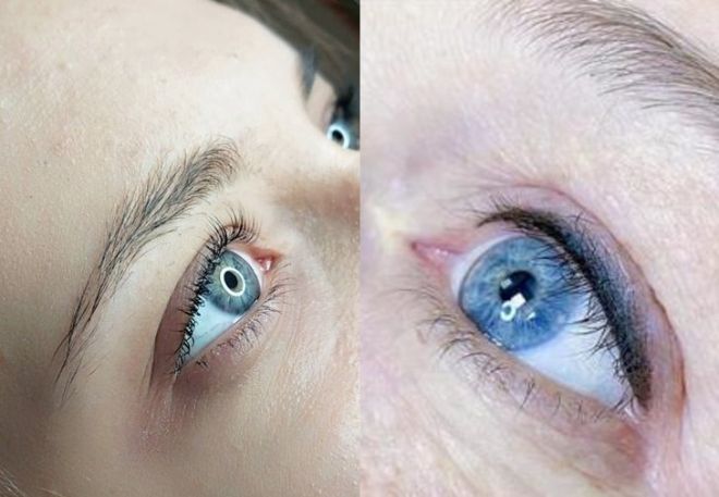 что лучше межресничка или стрелка что лучше межресничка или стрелка