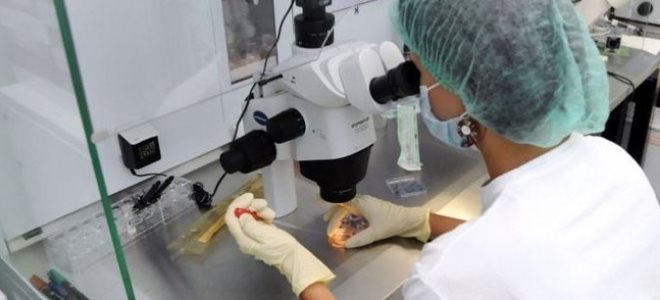 синдром поликистозных яичников симптомы