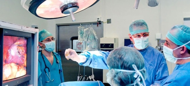 спкя в гинекологии